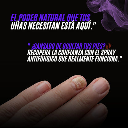 SPRAY NAIL FUNGUS - spray para hongos en las uñas